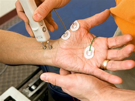 emg-ncv test price philippines|ELECTROMYOGRAPHY AND NERVE CONDUCTION .